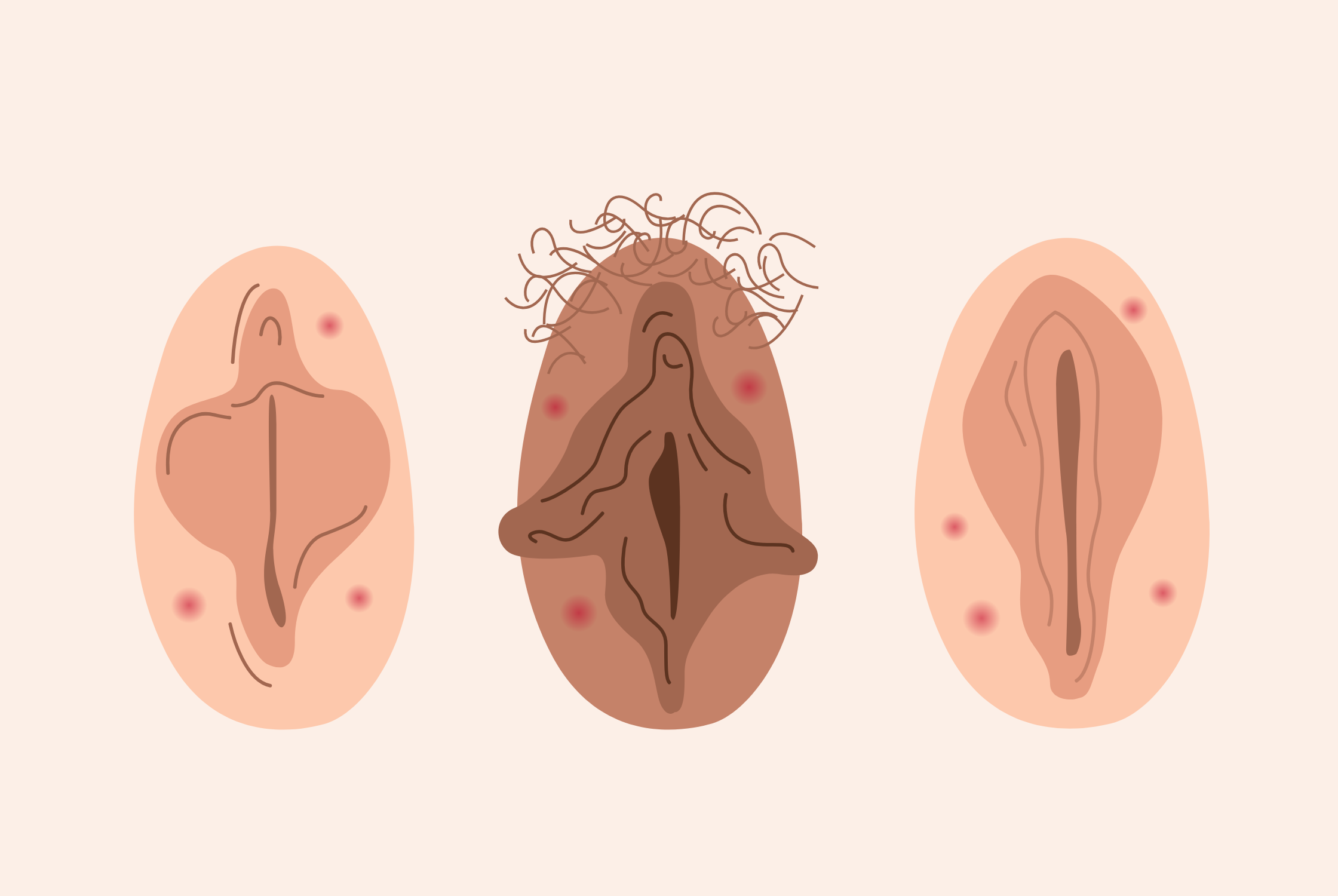 Reasons for Genital Pimples
