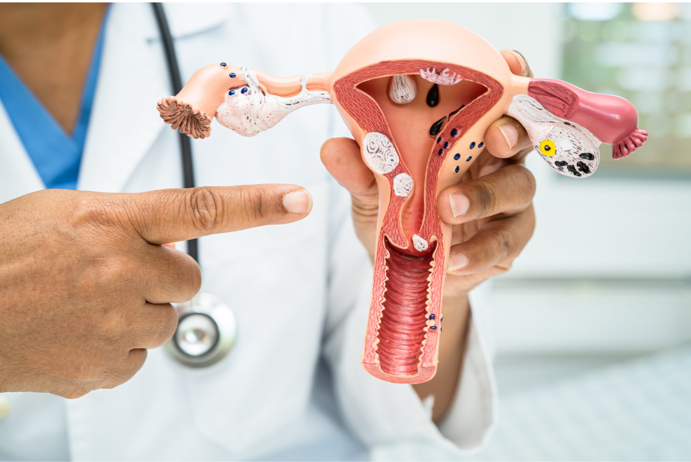 Would a Tilted Uterus (Retroverted Uterus) Affect My Fertility?