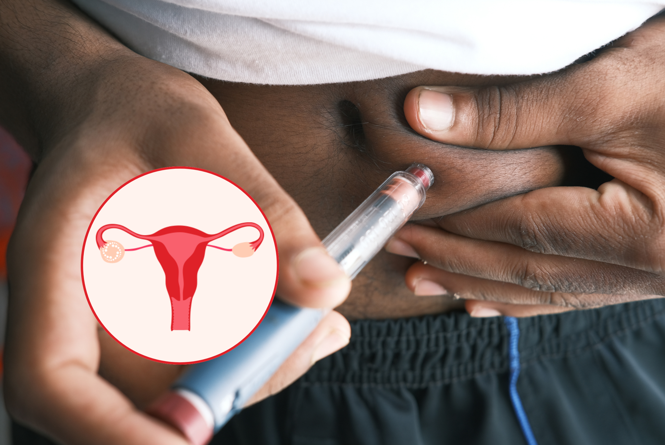 What’s the Link Between PCOS and Insulin Resistance?
