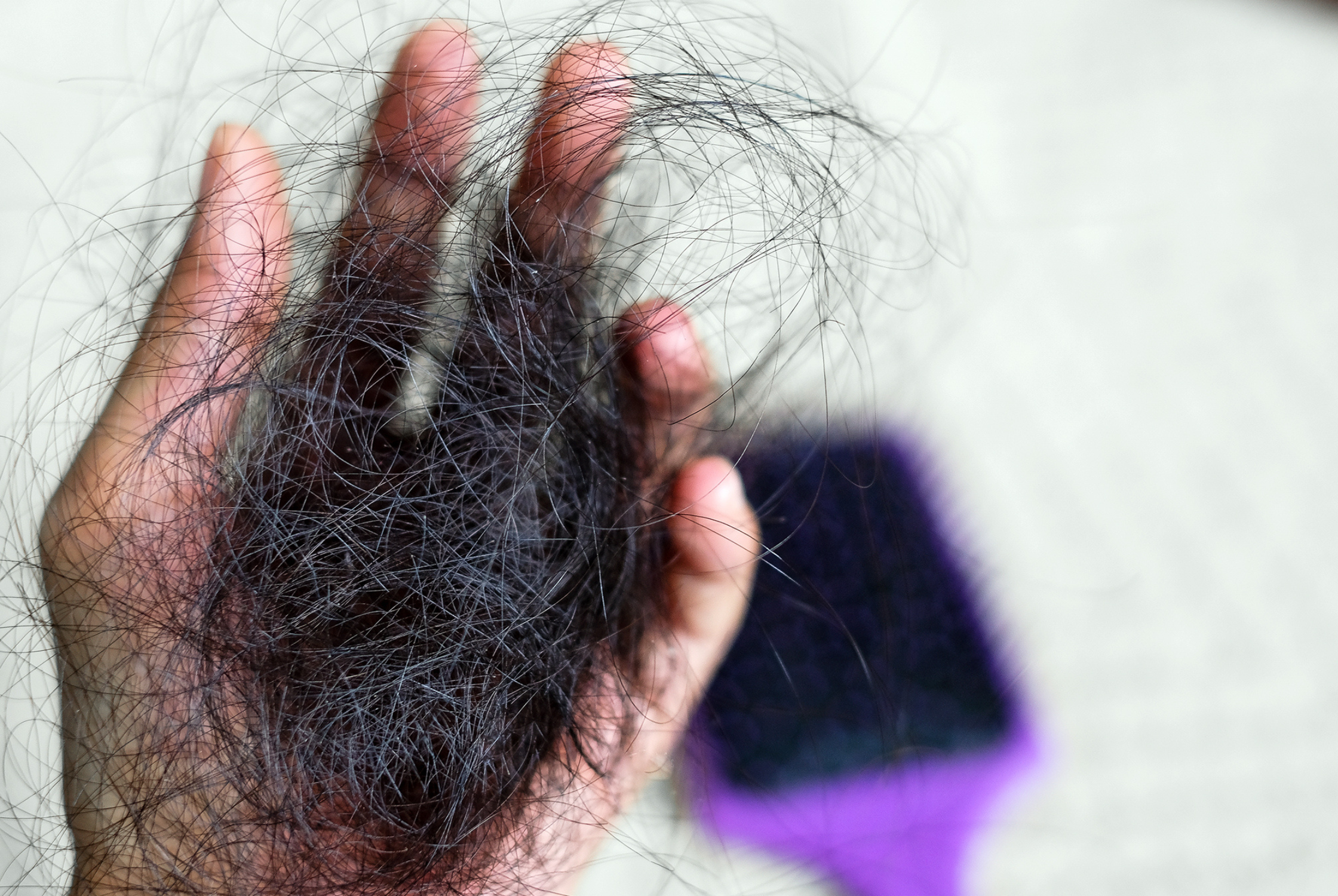Why Do Some Women Experience Postpartum Hair Loss?